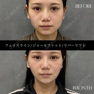 RIVER CLINIC（リバークリニック）大阪院の症例