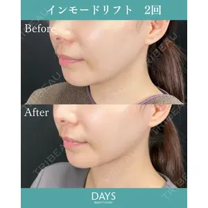 Days Beauty Clinic 新宿院の症例