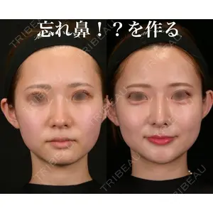 Zetith Beauty Clinic 銀座院 鉄 鑠医師の症例