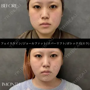 RIVER CLINIC（リバークリニック）大阪院の症例