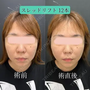 ルラ美容クリニック 新宿院 金田 成美医師の症例