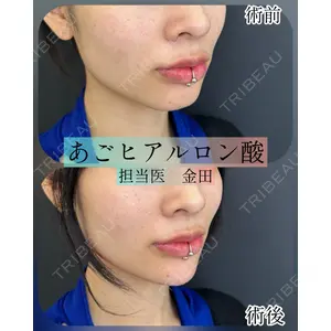 ルラ美容クリニック 新宿院 金田 成美医師の症例