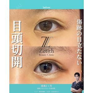 Zetith Beauty Clinic 銀座院 小川 悟史医師の症例
