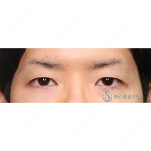 聖心美容クリニック 横浜院 佐々木 直美医師の症例