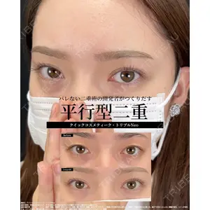 湘南美容クリニック 大阪梅田本院 横谷 仁彦医師の症例