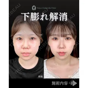 東京シンデレラ美容外科 池袋院 石井 達也医師の症例