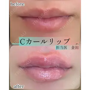 ルラ美容クリニック 新宿院 金田 成美医師の症例