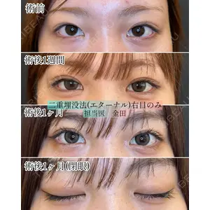 ルラ美容クリニック 新宿院 金田 成美医師の症例