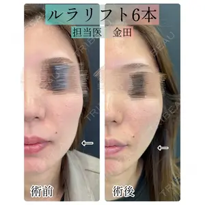 ルラ美容クリニック 新宿院 金田 成美医師の症例