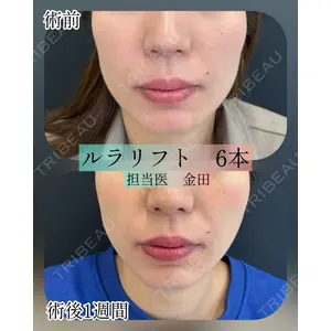ルラ美容クリニック 新宿院 金田 成美医師の症例