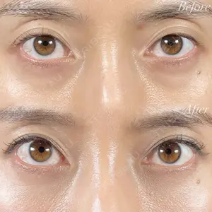 R Beauty CLINIC 銀座院 村山史朗医師の症例