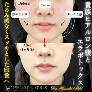 PRO CLINIC プロクリニック 銀座院 柚﨑 一輝医師の症例