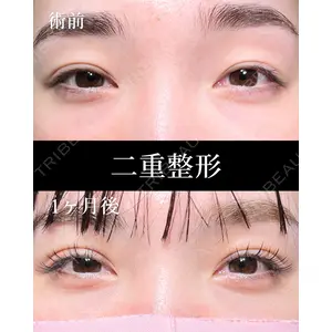 HAAB×DREAM BEAUTY CLINIC 大阪梅田院 鈴木 馨斗医師の症例