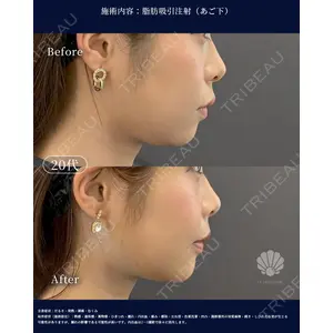LA MER CLINIC 辻 航平医師の症例