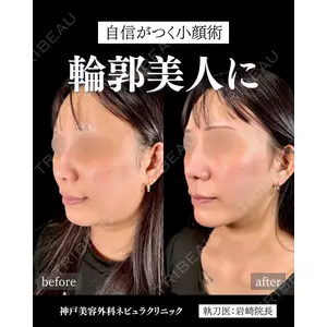 神戸美容外科 ネビュラクリニック 岩﨑 雅医師の症例