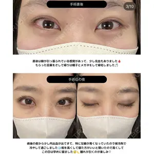 湘南美容クリニック 大阪梅田本院 横谷 仁彦医師の症例