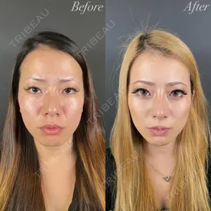 R Beauty CLINIC 大阪院 小池 泰弘医師の症例