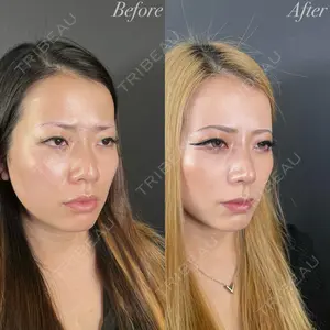 R Beauty CLINIC 大阪院 小池 泰弘医師の症例