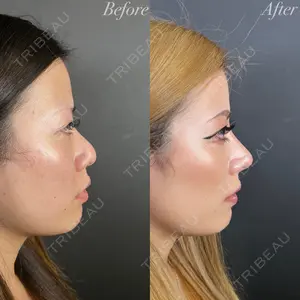 R Beauty CLINIC 大阪院 小池 泰弘医師の症例