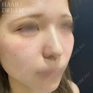 HAAB×DREAM BEAUTY CLINIC 東京本院 田中 優太医師の症例