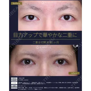 聖心美容クリニック 広島院 中辻 隆徳医師の症例