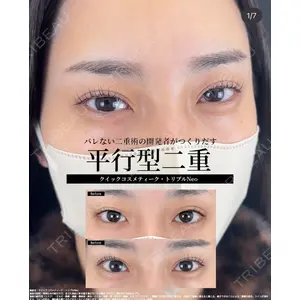 湘南美容クリニック 大阪梅田本院の症例