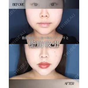 博多美容外科/美容皮膚科 ビラビューティークリニック 大村 亞蘭医師の症例