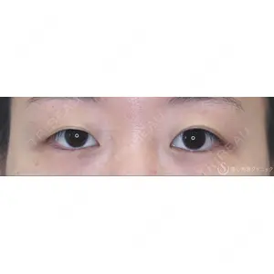 聖心美容クリニック 福岡院 美原 寿之医師の症例