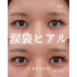 小暮整形外科・美容外科の症例