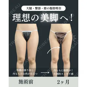 藤・ナチュレ美容クリニック 銀座院 鍵野 攻允医師の症例