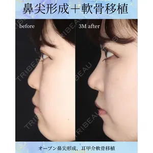 千葉美容外科アイビークリニック 藤田 愛樹医師の症例