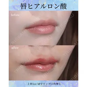 千葉美容外科アイビークリニック 藤田 愛樹医師の症例