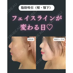藤・ナチュレ美容クリニック 銀座院 鍵野 攻允医師の症例