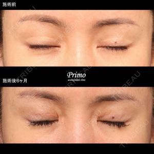 プリモ麻布十番クリニック 大場教弘医師の症例