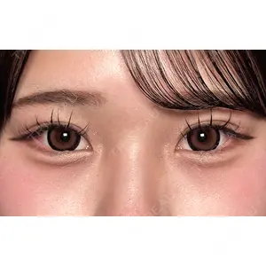 Moon Beauty Clinic 渡邉 正士医師の症例