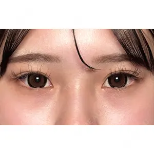 Moon Beauty Clinic 渡邉 正士医師の症例