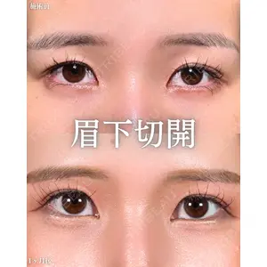 新宿美容外科ネビュラクリニック 山本 紘子医師の症例
