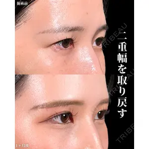 新宿美容外科ネビュラクリニック 山本 紘子医師の症例