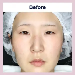 吉祥寺アイビークリニック 升本　浩紀医師の症例