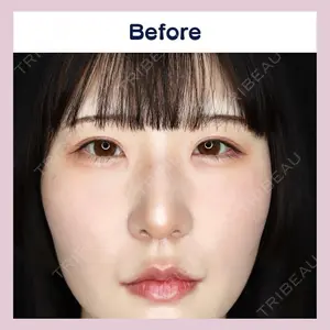 吉祥寺アイビークリニック 升本　浩紀医師の症例