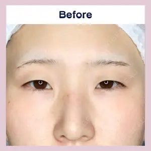 吉祥寺アイビークリニック 升本　浩紀医師の症例