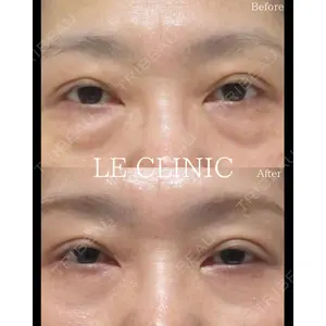 LE CLINICの症例