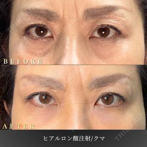 BiBiクリニックの症例