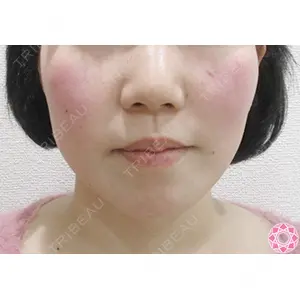 東京形成美容外科 船橋院 弓削田　浩主医師の症例