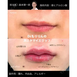 PRISM Beauty Clinic 町田院 森本 理一郎医師の症例