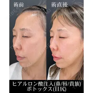 HAAB×DREAM BEAUTY CLINIC 大阪梅田院 柏木 太雅医師の症例