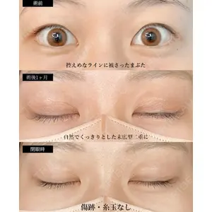 湘南美容クリニック 大阪梅田本院 横谷 仁彦医師の症例