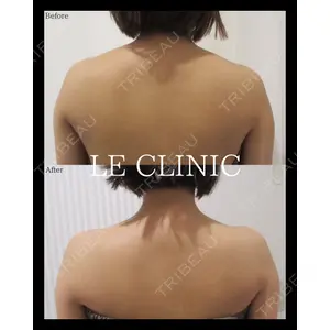 LE CLINICの症例