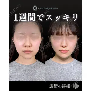 東京シンデレラ美容外科 池袋院 石井 達也医師の症例