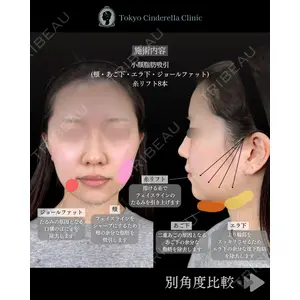 東京シンデレラ美容外科 池袋院 石井 達也医師の症例